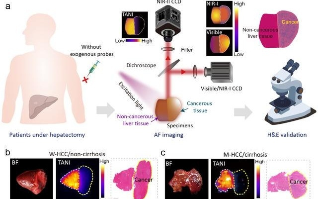 复旦团队研发可视化成像技术，无需注射造影剂助力肝脏肿瘤切除