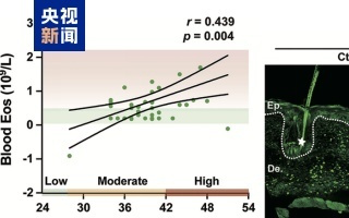 压力大会加重皮炎 中国科学家首次发现科学证据