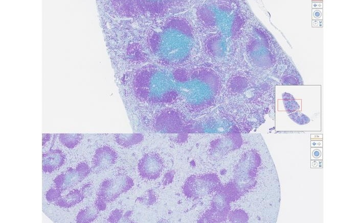 纳米颗粒在人体内“教导”T细胞精准“杀敌”