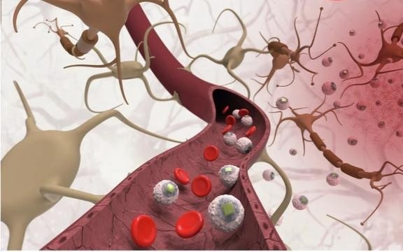 陈天桥投资MIT颠覆性研究：脑机接口可从静脉注射“智能芯片”直抵大脑