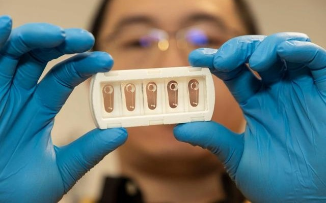 新研究：3D打印“芯片动脉”或助揭示中风之谜