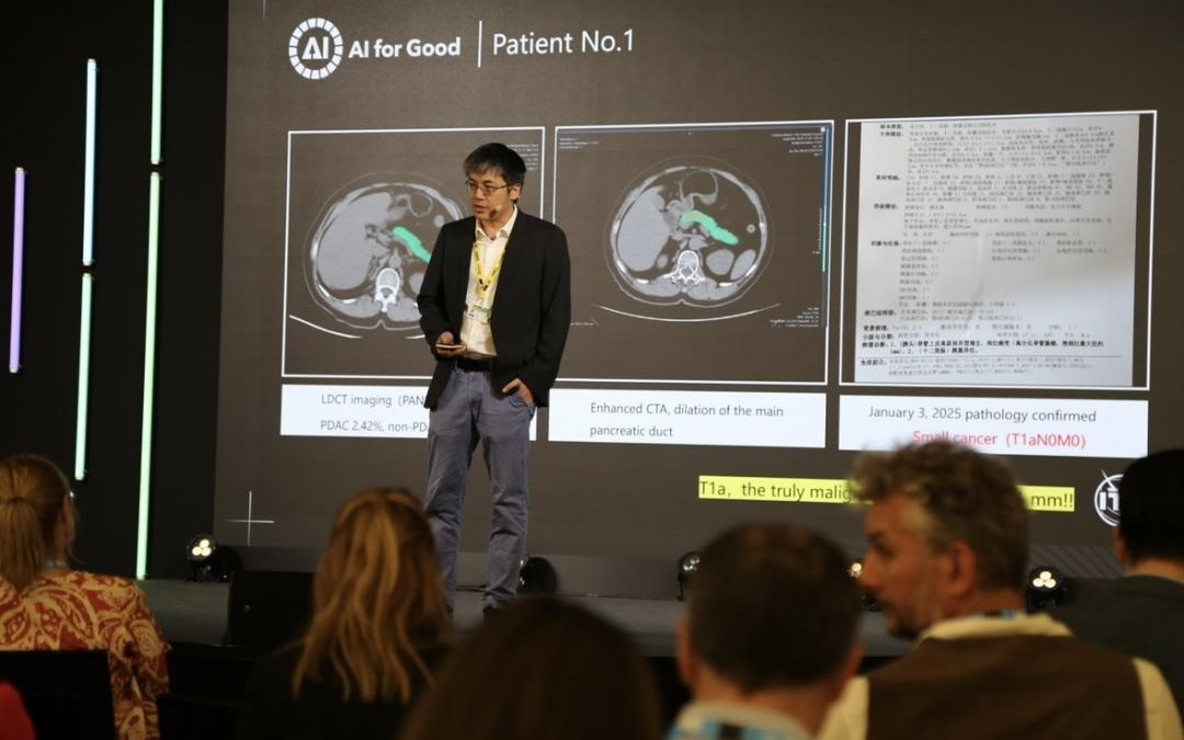 服务9个国家地区2000万人次 阿里多癌早筛AI亮相联合国AI峰会