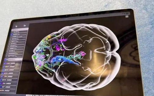 超300人团队共同完成！中国科学家十项成果给大脑绘高清地图