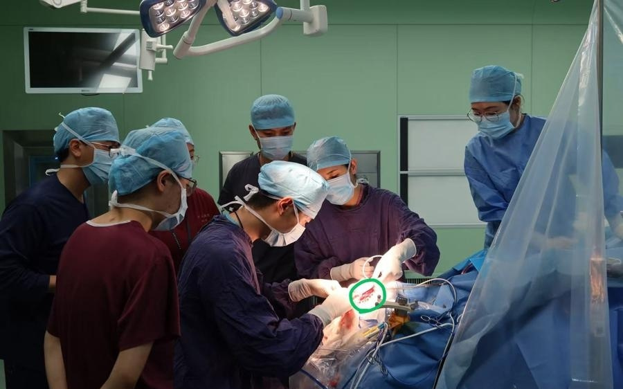 获批全球脑机接口上市“第一证”，上海做对了什么