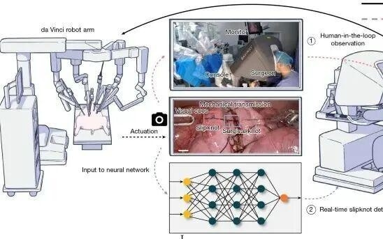 一个“活结”的智慧：浙大Nature发表封面论文，解决微创手术打结难题｜光锥读论文