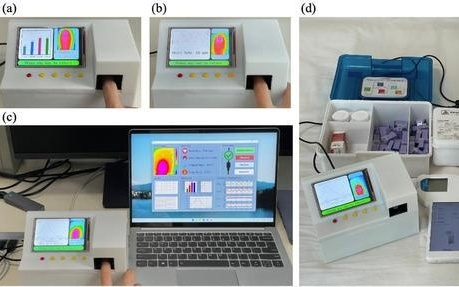 精准+便携 东北师范大学物理学院无创血糖监测实现技术新突破
