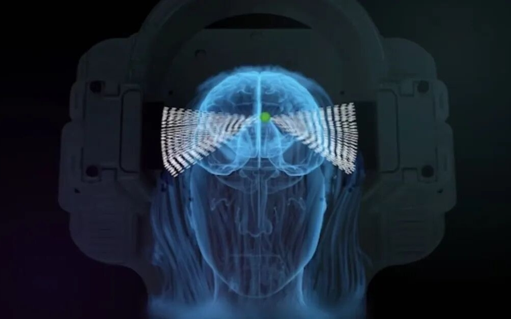 陈天桥再投资，押注中国首家超声波脑机接口公司