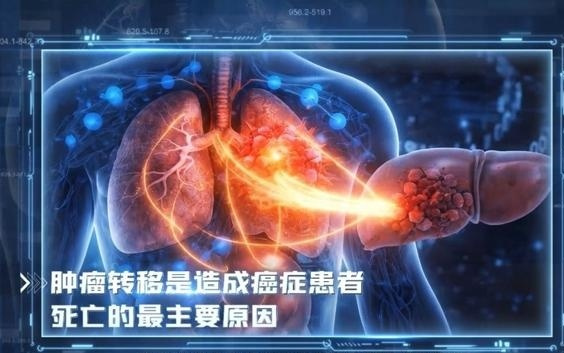 上海科学家开发新技术，揭示转移瘤免疫治疗耐药的关键机制