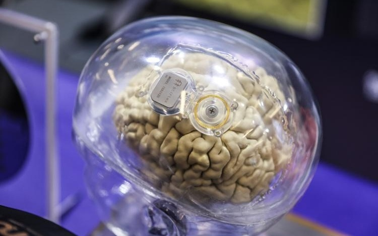 未来已来！脑机接口下一步：增强人类