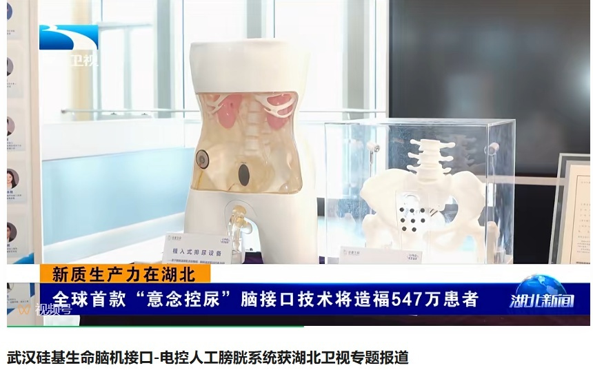 国内企业研发全球首款脑控“人工膀胱”系统，未来还有人工括约肌
