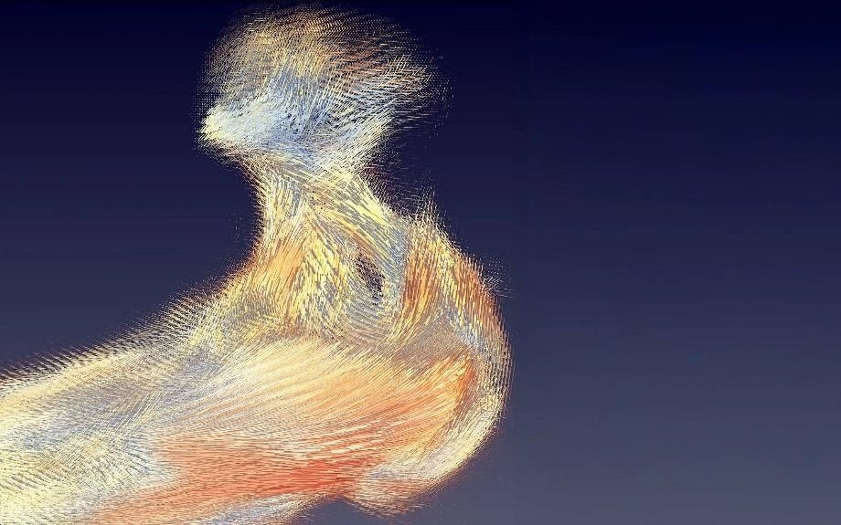 X射线衍射新技术一小时“看透”生物结构