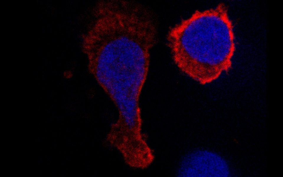 破解30年难题：科学家首次分离出活体艾滋病HIV病毒库细胞