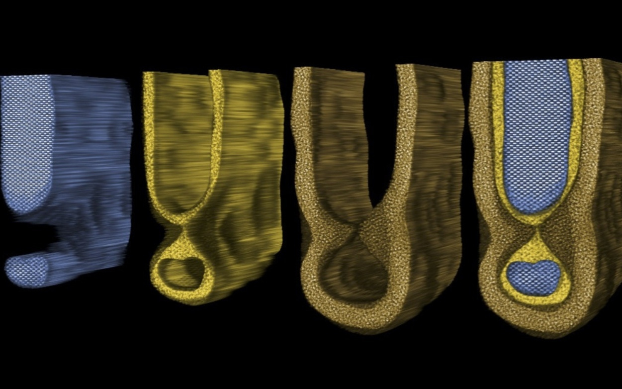 人类首次直接观察到芯片“鼠咬”缺陷，有望彻底改变半导体研发