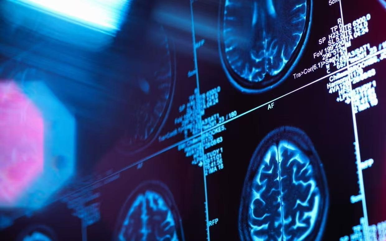 剑桥最新研究：人类大脑32岁才真正“成年”，一生还有4次关键转折