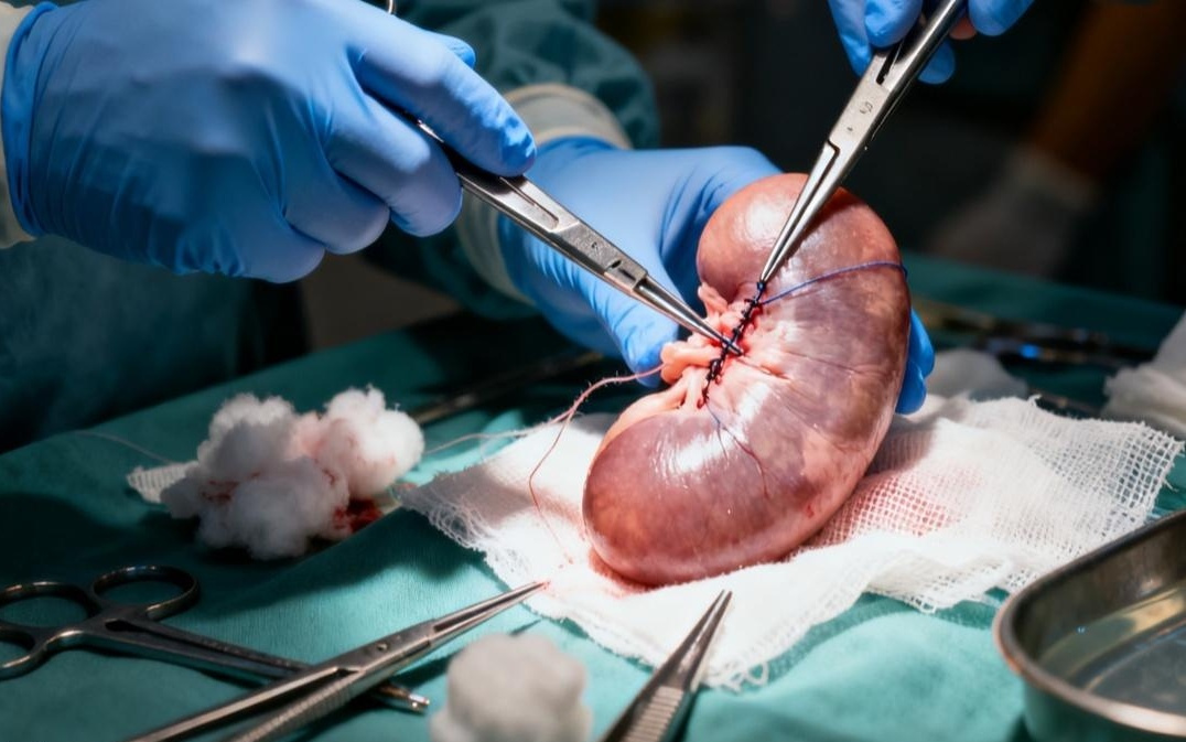 异种移植迎突破：美国启动人体移植基因编辑猪肾规模化临床试验