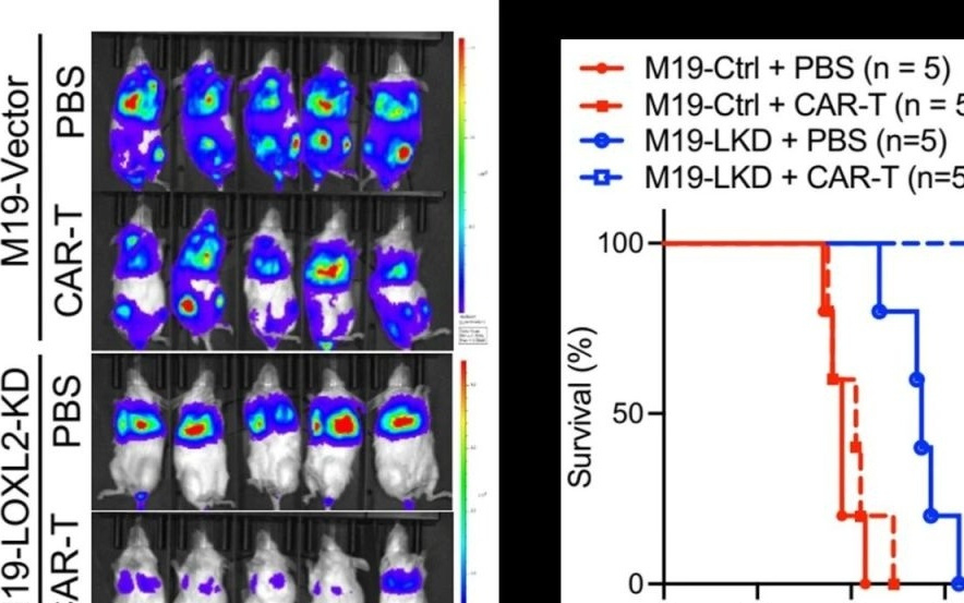 免疫治疗为何对转移瘤无效？中国科学家揭秘其防护机制