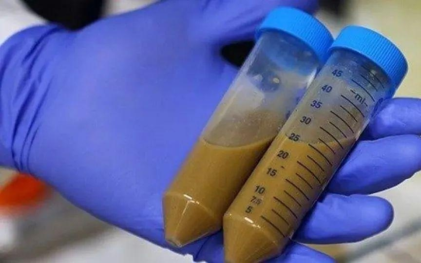 把人类大便做成冻干装进胶囊，医生正在研发可以治好多种病的“超级新药”