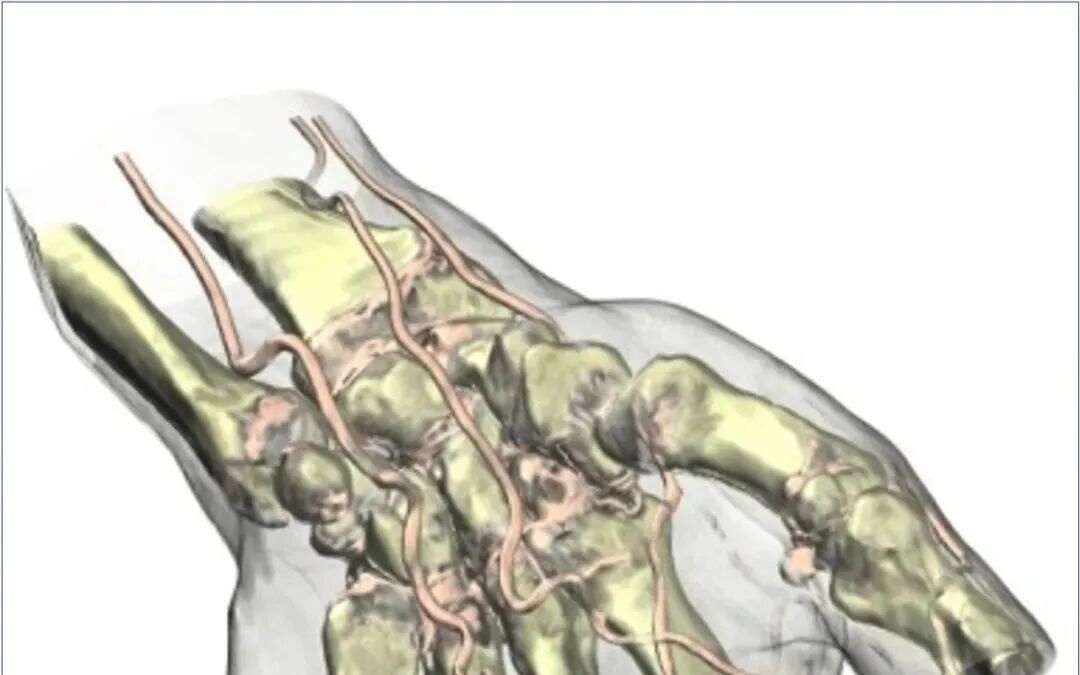 南丁格尔做了张“玫瑰图”，结果把士兵的死亡率从42%降到2.2%