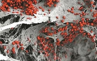 再生医学重大突破 用人类细胞构建三维骨髓组织模型