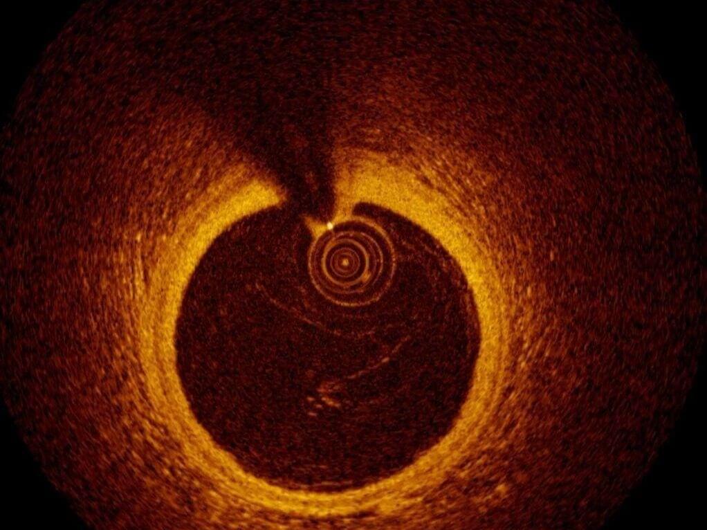临床PK完胜ChatGPT-5!国内团队造出首个OCT影像AI系统