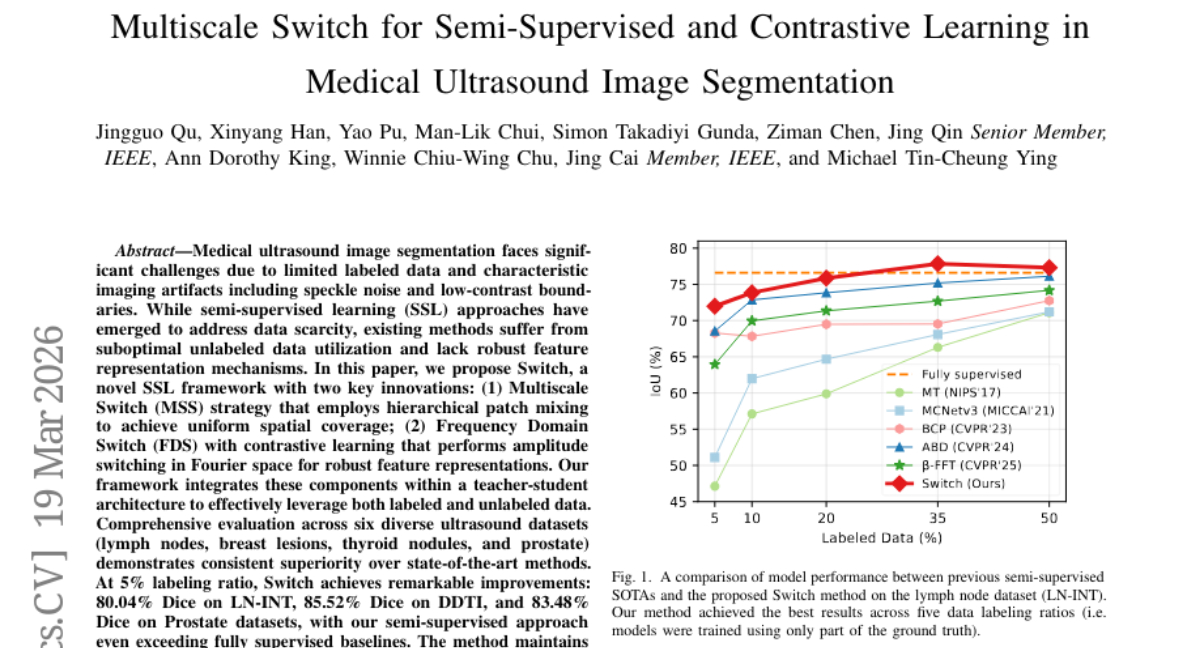 香港理工突破：5%标注数据实现AI超声图像精准识别能力提升