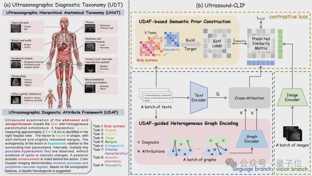 36.4万超声图文对！中国团队构建首个大规模超声专属数据集