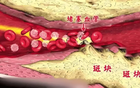 85度C奶茶喝出死蟑螂 客服称已作出“一赔十”补偿【综合】风尚中国网