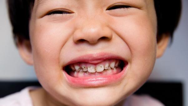 梦见长蛀牙了，梦境背后的深层含义与心理解析