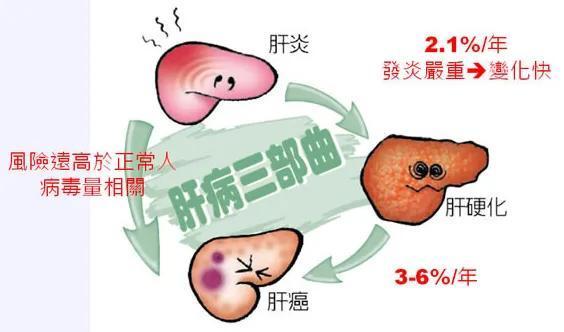 肝硬化怎么治疗（肝硬化怎么治疗和保养）