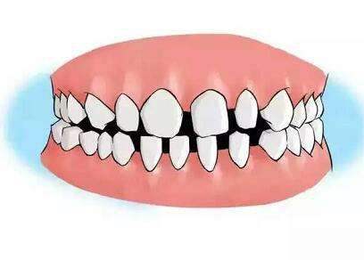 梦见自己右下方的牙齿掉了，预示未来变化与自我成长的象征