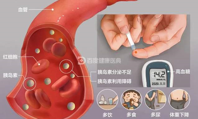 男子眼(yan)睛(jing)糢(mo)餬，半(ban)年后離(li)世(shi)，直(zhi)到兒子也(ye)確(que)診(zhen)：沒(mei)有(you)正確治療的(de)悲劇