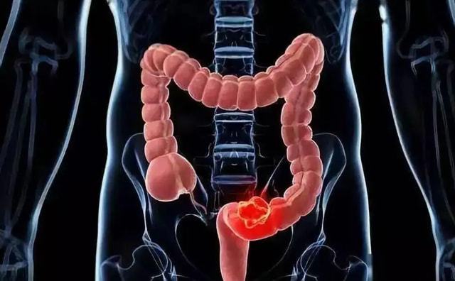 昨晚梦见自己得癌在大便池里等死，一场梦境的深层解析与心理启示