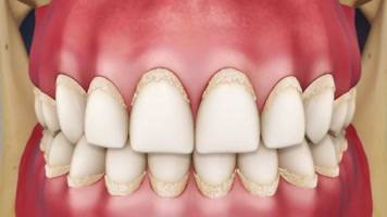 孕妇连续2天做梦梦见掉牙，梦境背后的深层含义与解读