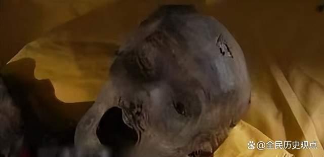 梦境中的奇异循环，打死虫子后的重生与蜕变