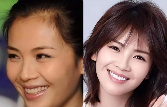 梦见下面左口牙齿松动一拔就掉一瓣，拔光一颗牙旁边的也松了不痛，梦境背后的深层含义