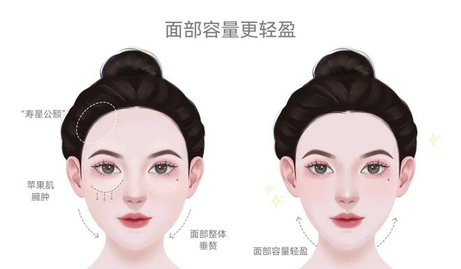 重塑你的美——家用美容仪品牌TOP 10 