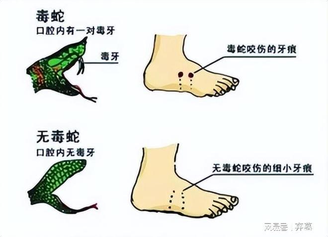 梦魇之巅，上坡遇险，五步蛇咬脚后跟的深层寓意解析