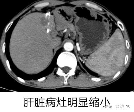 梦境解析，怀孕与出血的交织——探索内心深处的母性焦虑与希望