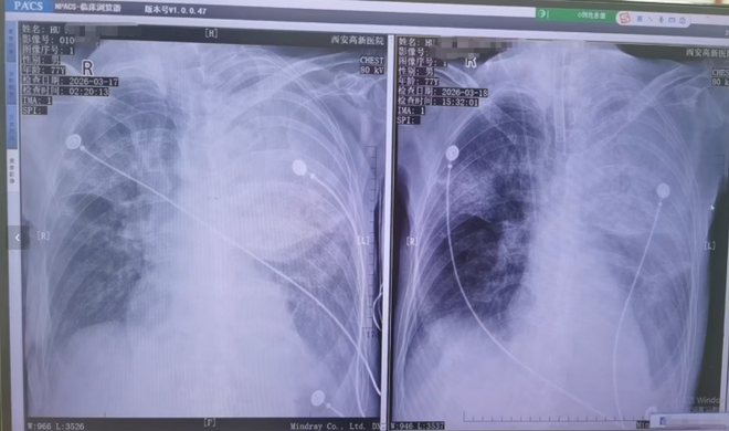 “dy评论如何快速涨赞？揭秘热门技巧！”