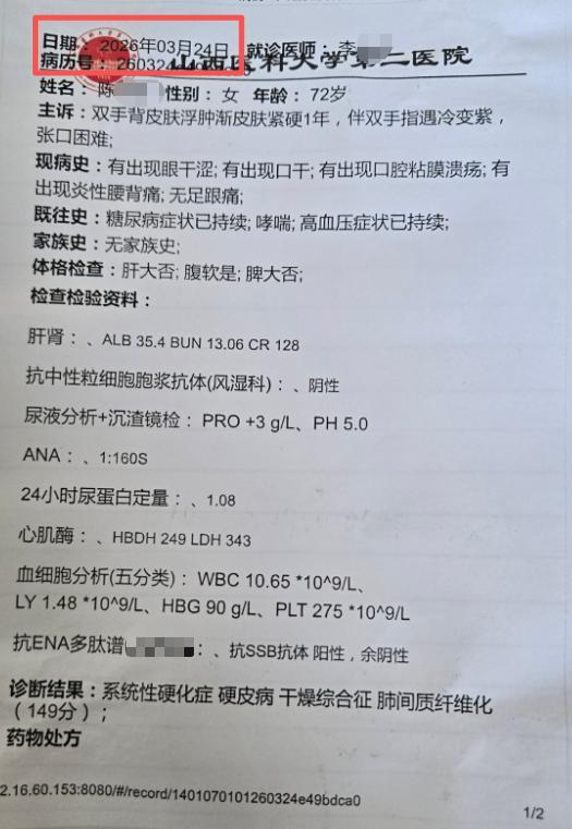 抖音点赞兼职，一单一结靠谱吗？