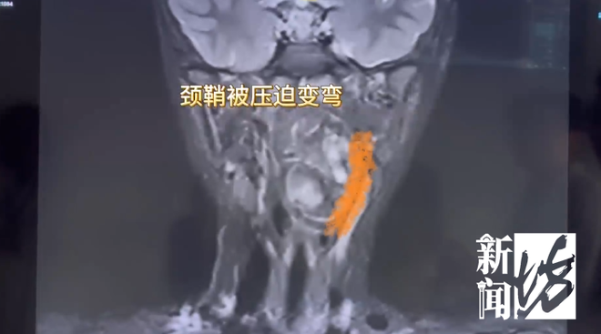 买赞-抖音怎么增加点赞是什么?