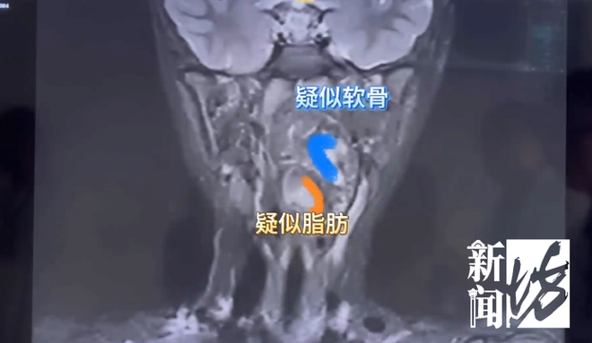 买赞-抖音怎么增加点赞是什么?