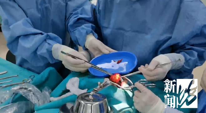 买赞-抖音怎么增加点赞是什么?