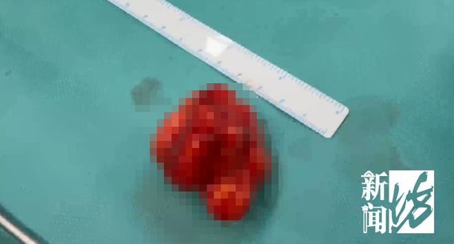 买赞-抖音怎么增加点赞是什么?