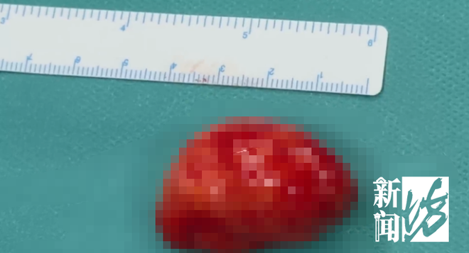 买赞-抖音怎么增加点赞是什么?