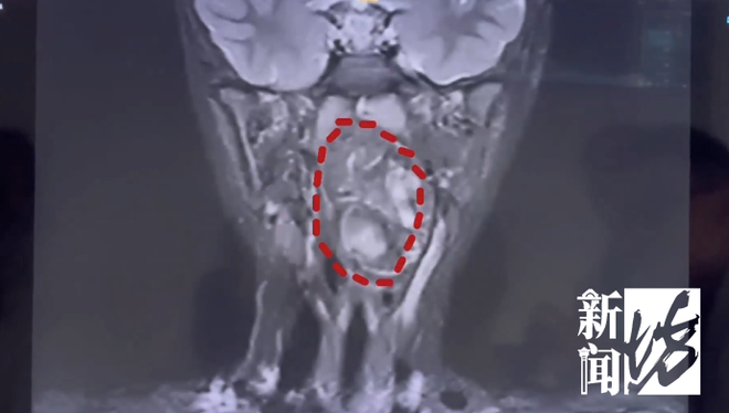 买赞-抖音怎么增加点赞是什么?