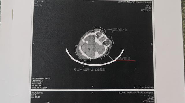 抖音真人点赞网站，真的能助力爆火吗？