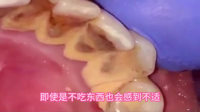 梦境解析，频繁梦见牙齿掉落——疼痛与流血背后的深层含义
