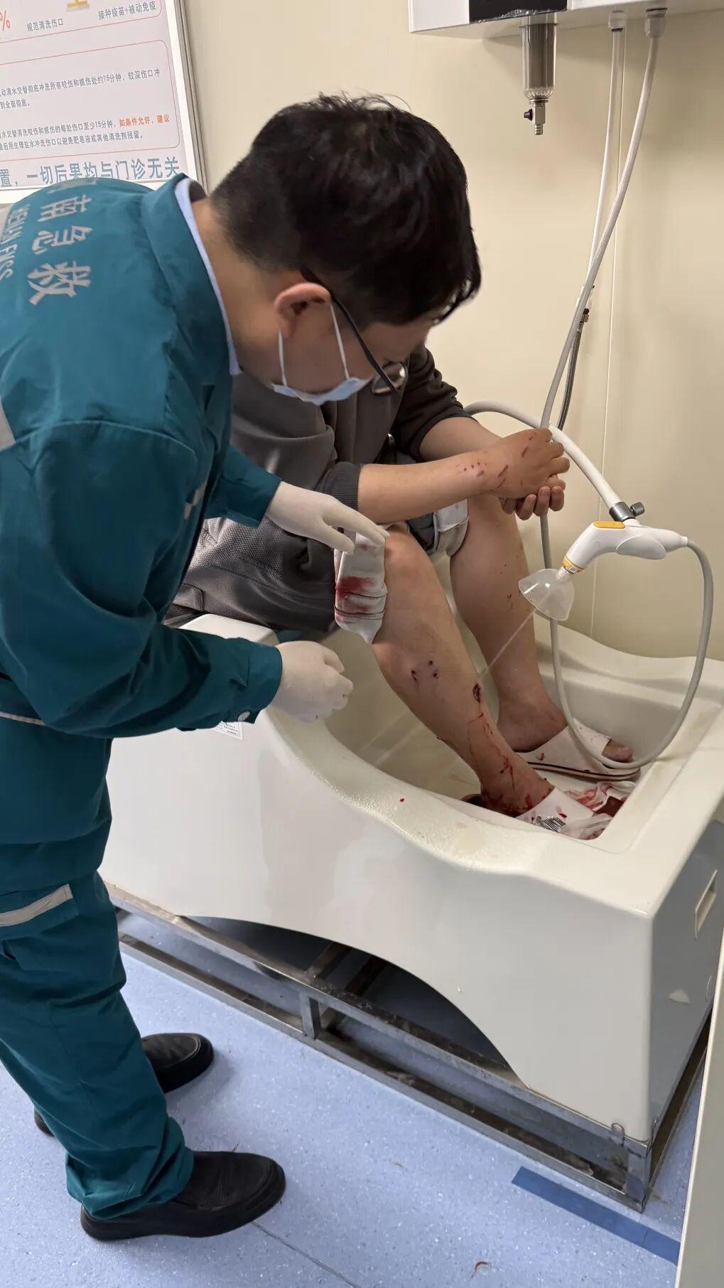 5年爱宠突然发狂，38岁男子小腿遭重创：伤口如乒乓球大，深度惊人！医生警示：春季高发期，慎逗！